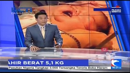 Bayi Lahir dengan Ukuran Fisik Setara Usia 5 Bulan