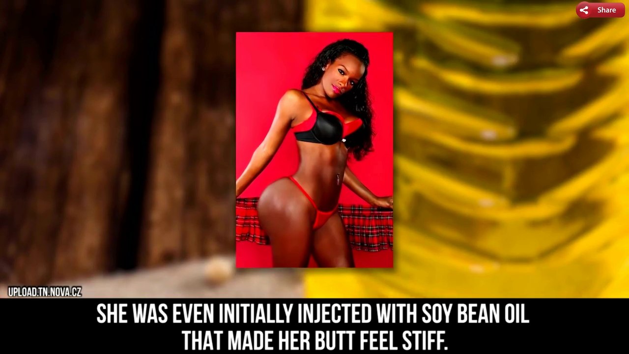 10 Most SHOCKING Body Part TRANSFORMATIONS  ...
