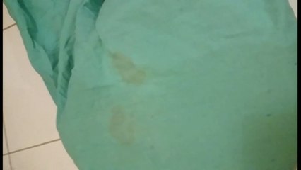 supprimer tache de sang sur un tissu déjà lavé