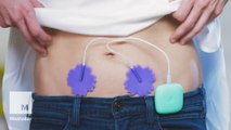 Zap away period cramps with this tiny device