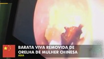 Barata viva removida de orelha de mulher chinesa.
