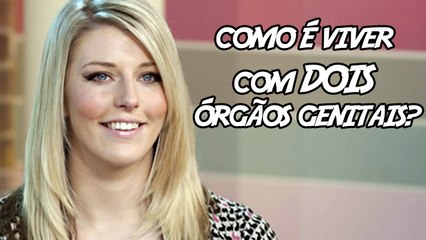 5 pessoas que chocantemente possuem partes extras no corpo