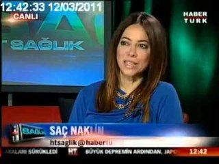 Saç naklinde ön testler var mıdır ?