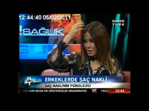 Saç nakli özgüveni artırır mı ?