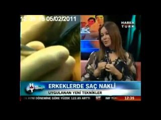 Saç naklinde uygulanan kaç teknik vardır ?