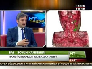 Baş boyun kanserinin nedenleri ve tedavisi ?