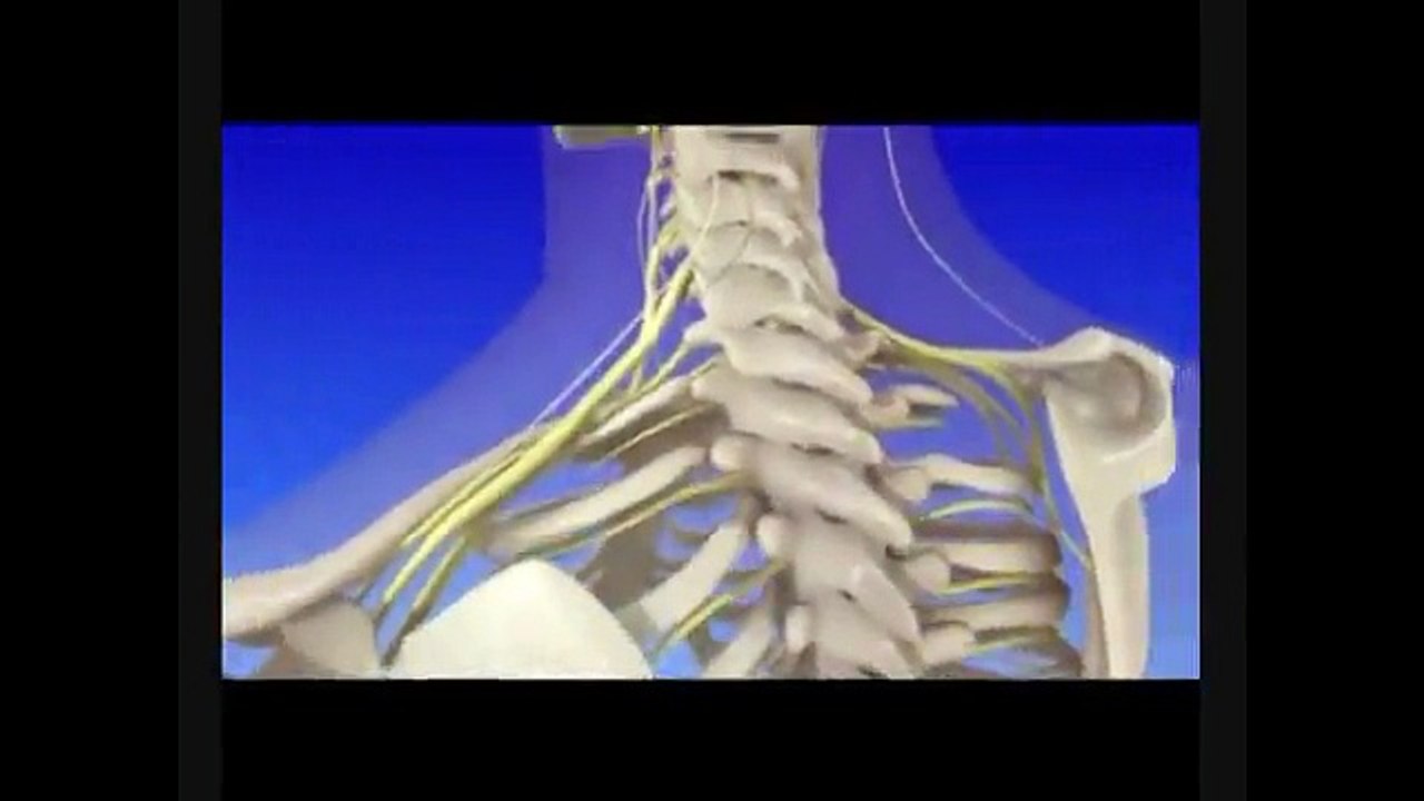 علل درد گردن - دکتر علی نقره کار