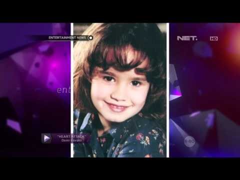 Artis yang Pernah Dibully Tapi Sekarang Sukses