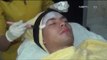 Fero Walandouw Jalani Treatment Accure Laser