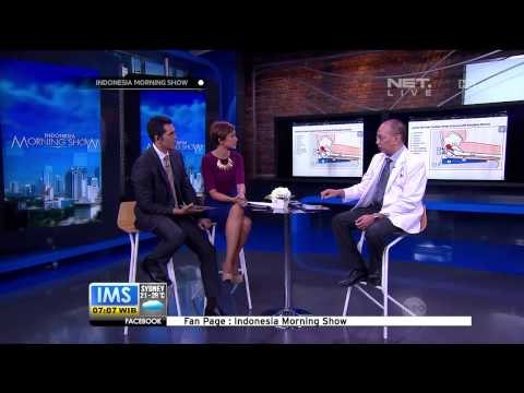 Talk Show Kesehatan Wallet Sciatica bersama Dokter Spesialis Tulang - IMS