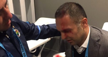 Fenerbahçe Menajerinin Başı Sahaya Atılan Yabancı Maddeyle Yarıldı