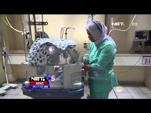 Bayi kembar siam dempet kepala dirawat di RS Banda Aceh - NET5
