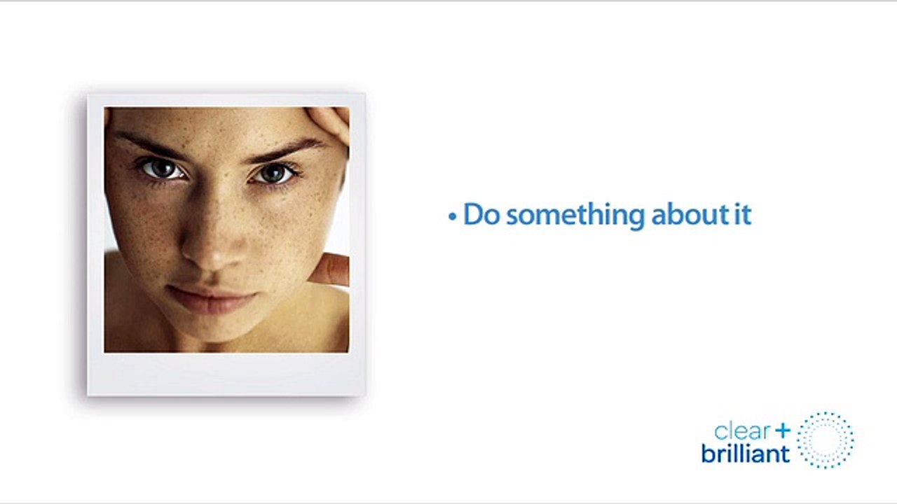 Clear + Brilliant® System - SOLTA MEDICAL - QuoteMontage