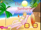 Elsa terbakar matahari Permainan - Play Elsa Sunburned Game