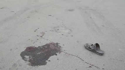 Casi 3.500 muertos y 8.000 heridos civiles en Afganistán en 2016