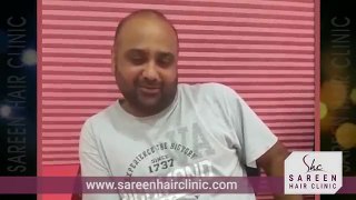 Hair Transplant Reviews New Delhi - Hair Loss Treatment Experience India