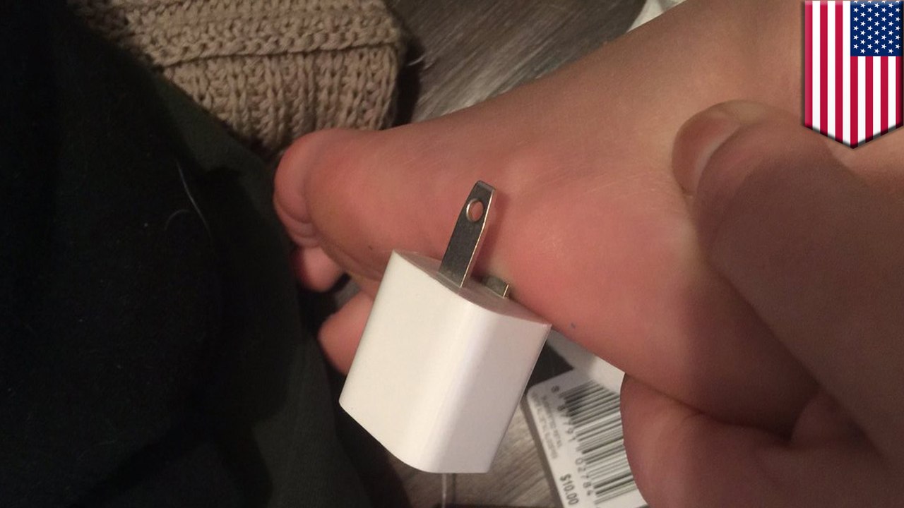 Nebraska teen's pic of her charger-in-foot injury goes viral - video  Dailymotion
