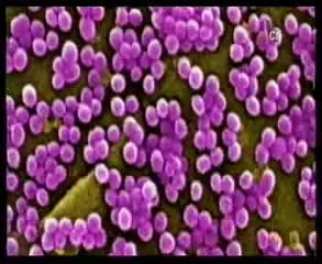 MRSA: Estafiloloco aureo resistente a la meticilina (Autopsia forense)