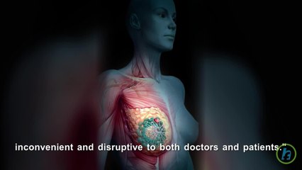 50% of Breast Cancer Patients Experience Severe Side Effects