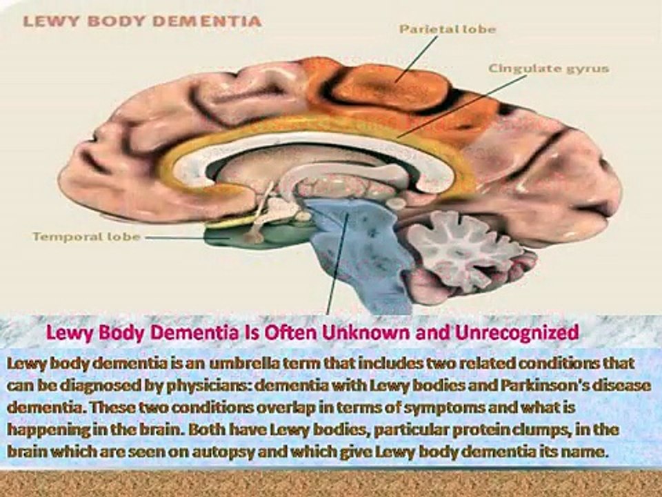Get pointers to stay A Neurological lifestyles --Dr. Philip Leonard--