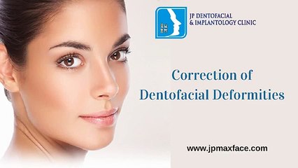 Jaw Correction Surgery in Thrissur - Best Dental Clinic in Kerala