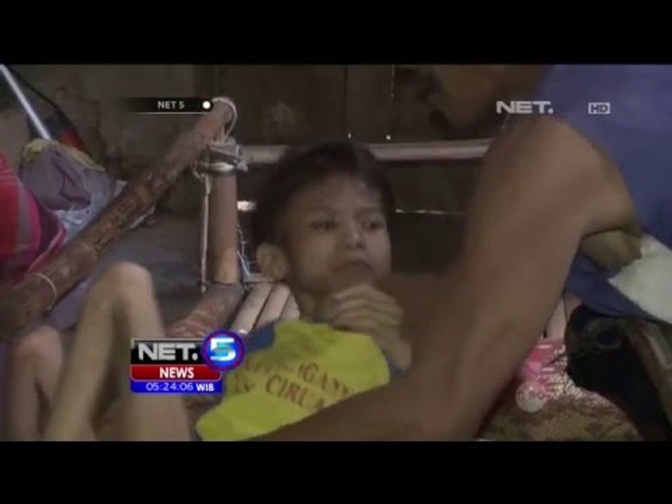Prihatin!! Kondisi Afin yang Menderita Gizi Buruk - NET5