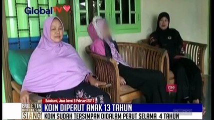 Download Video: Astaga, Uang Koin Berada di Perut Anak Ini Selama 4 Tahun