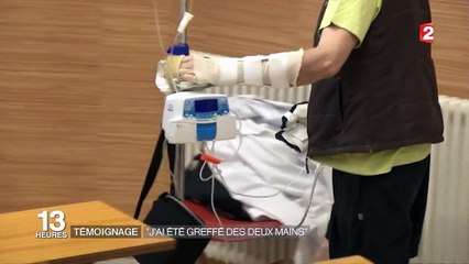 Santé : le témoignage d'un greffé des deux mains