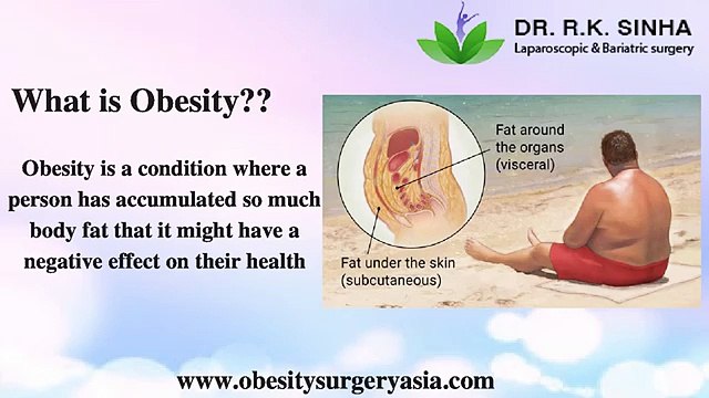 Bariatric Surgery In Mumbai - Weight Loss Treatment In India (1)