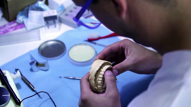 Dental Veneers in Tustin Orange County 714 909-1311 - YouTube_720p