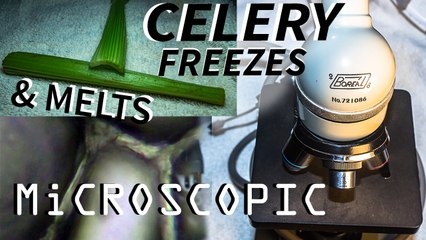 Killer Frost Destroys Celery Under The Microscope