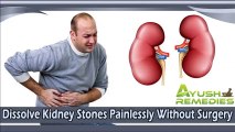 Dissolve Kidney Stones Painlessly Without Surgery
