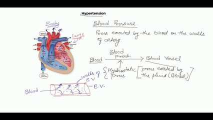 Understanding Hypertension: Causes, Stages & Prevention 🩺