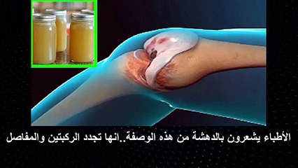 الاطباء يصعقون بالدهشة من هذه الوصفة..انها تجدد الركبتين والمفاصل