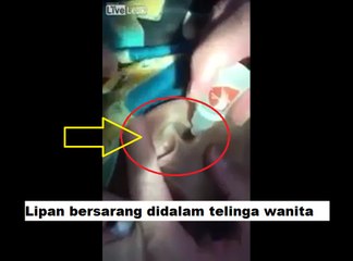 Ngeri...!!! Ada Lipan Masuk ke Telinga Gadis Ini - NEWS_x264