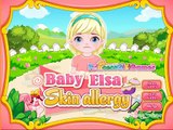 Baby Elsa Skin Allergy - Frozen Games