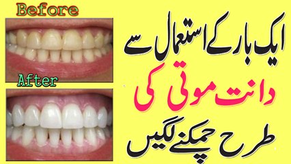 Teeth Whitening Tips In Urdu | Danton Ko Chamakdar Banane K Liye Nuskha
