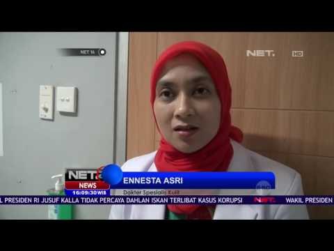 Korban Reaksi Obat, Kondisi Ilham Terus Membaik - NET 16