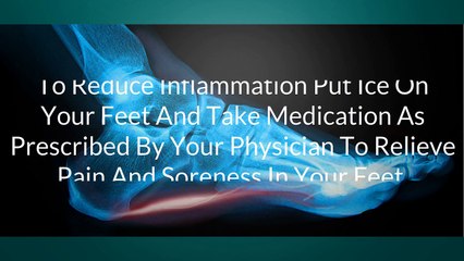 Cure Plantar Fasciitis