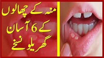 Munh Ke Chalay Door Karne Ke 7 Gharelu Totkaydaily news