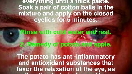 43.Forget the tired eyes 3 home remedies to calm the feeling of tired eyes