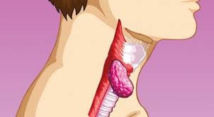 Symptoms of a Sluggish Lymphatic System