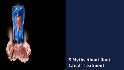 5 Myths About Root Canal Treatment