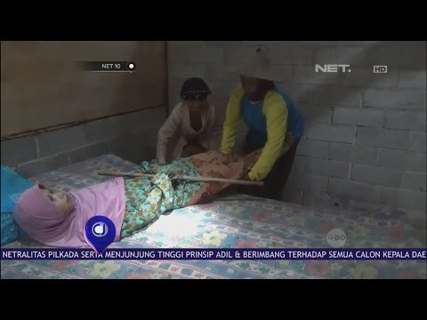 Derita Manusia Kayu, Puluhan Tahun Tubuh Sulit Bergerak - NET 10