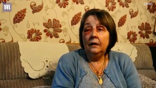 Grandmother reveals she was kicked in face by violent mugger