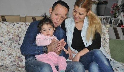 Yüz nakli olan Recep Sert'in kızı Hira 1 yaşında