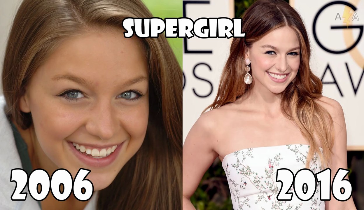 SuperGirl Avant et après 2016