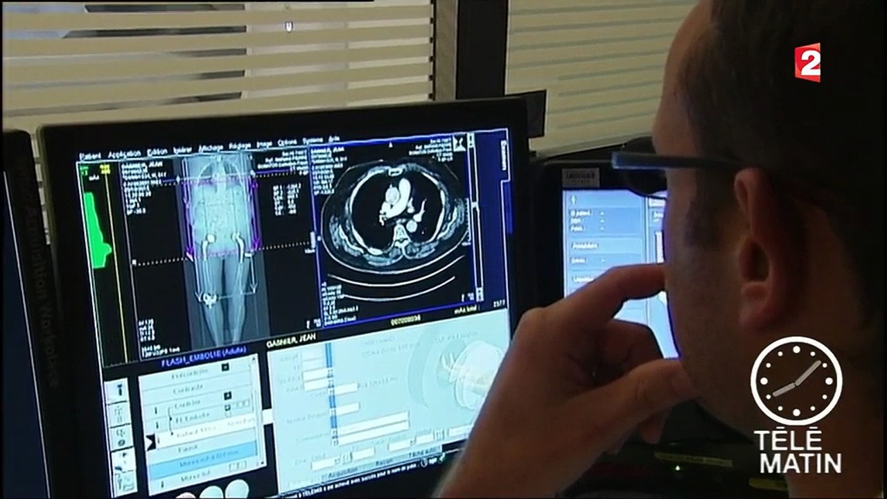Santé : les délais d'attente pour un scanner ou une IRM risquent de s'allonger