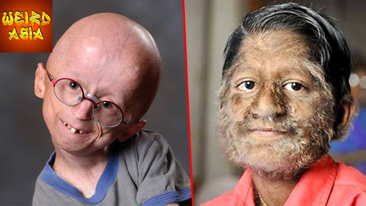 5 WEIRD Diseases | Weird Asia