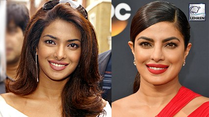 Priyanka Chopra TALKS About Her Plastic Surgery